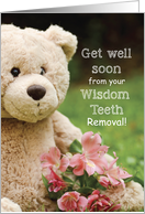 Wisdom Teeth Removed...